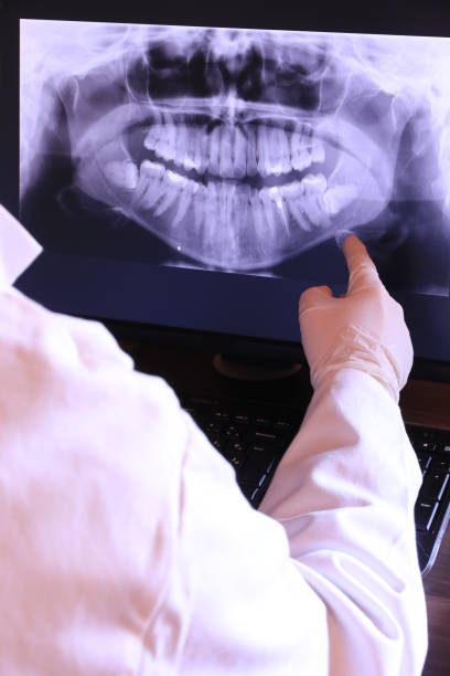 Best Broken or Chipped Tooth Repair in Manhattan Beach, CA