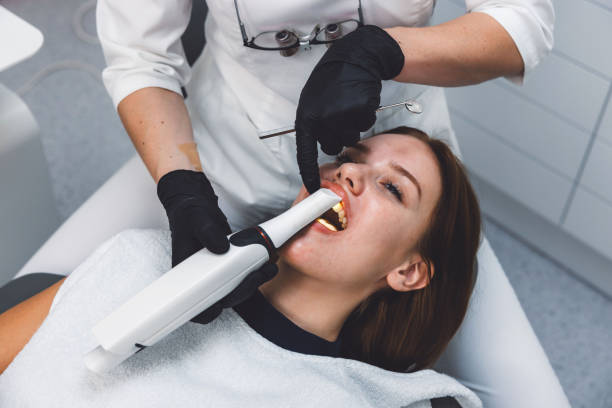 Best Emergency Wisdom Tooth Extraction in Manhattan Beach, CA